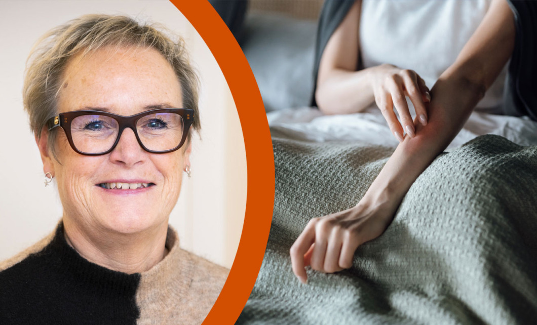 ”Unga med eksem behöver mer hjälp”