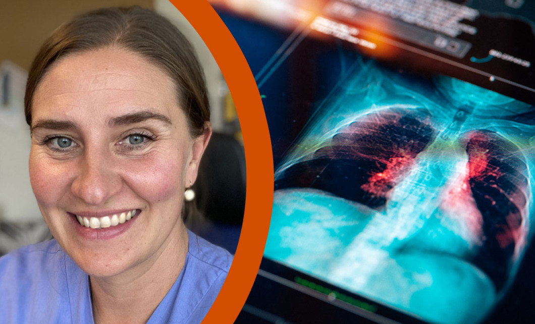 Pilotstudie på röntgen: ”Vi gör en insats för att hitta lungcancer tidigt”