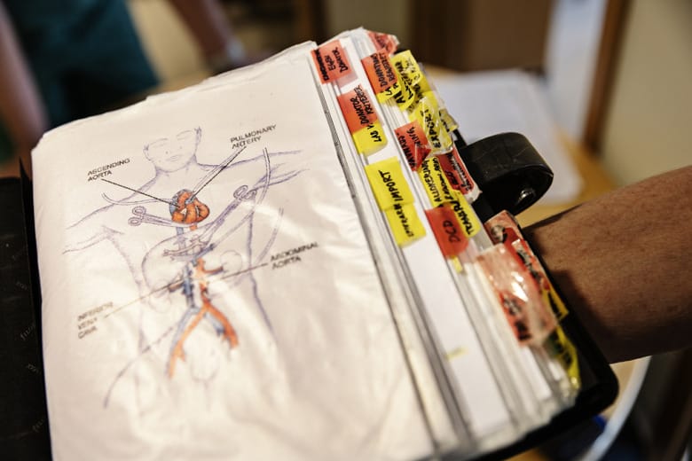 En pärm med inplastade papper och massvis med flikar och anteckningar över olika saker som har med donation att göra. Den första sidan visar en illustrerad bild av en människa där några olika delar av kroppen är utpekade.