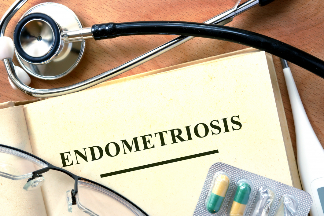 Viktigt med tidiga insatser vid endometrios