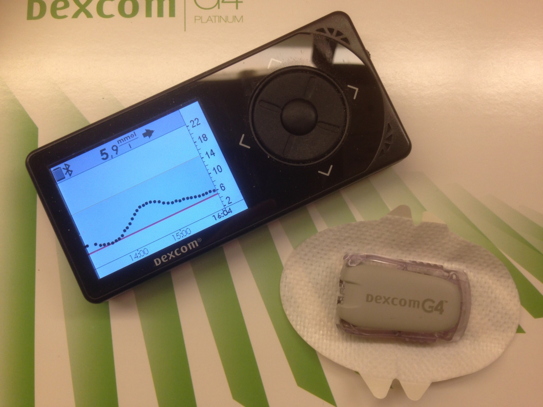 Kontinuerlig mätning sänker blodsockret vid typ 1-diabetes