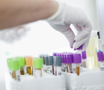 Landstinget i Värmland varslar biomedicinska analytiker