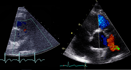 Snabb teknikutveckling gör bilddiagnostiken osäker