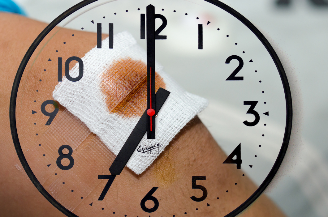 Sår som uppkommer på natten läker långsammare