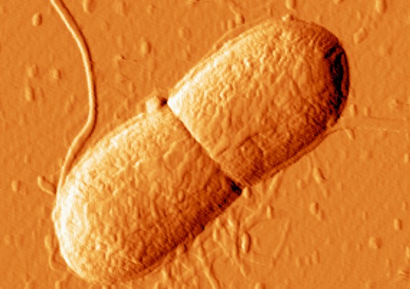 Resistens upptäckt mot sista linjens antibiotika