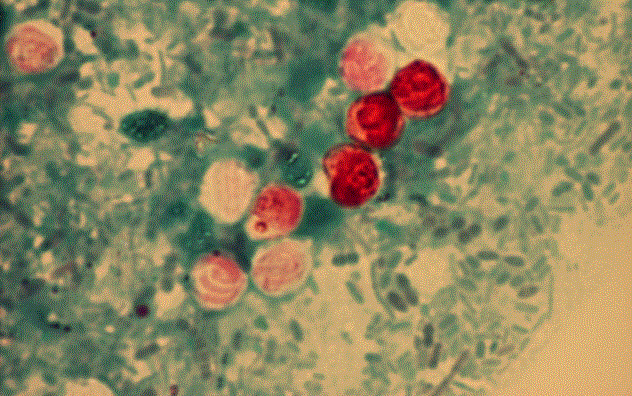 Bekräftat fall av Cryptosporidium meleagridis