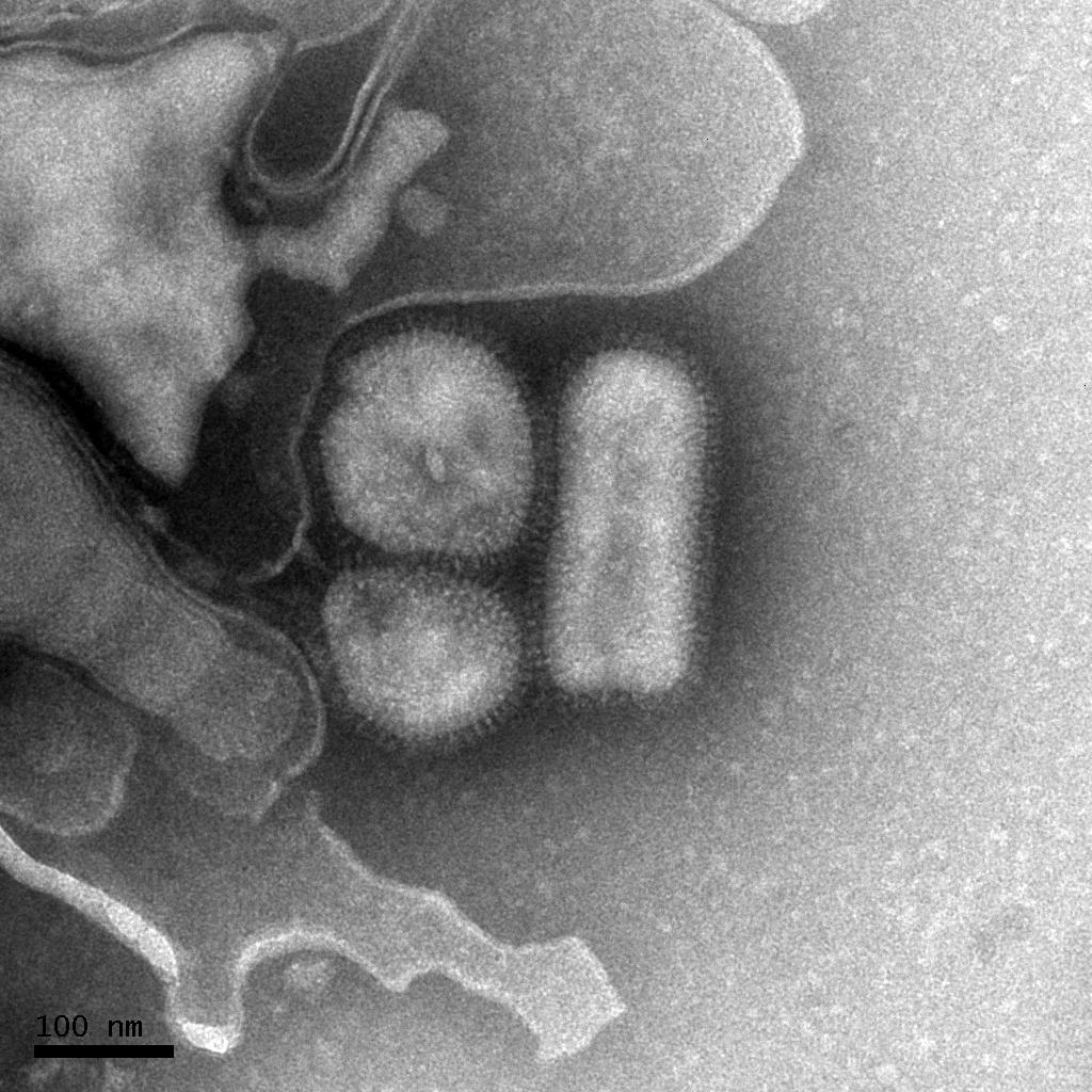 Dödsfallen i svininfluensa betydligt fler än man tidigare trott