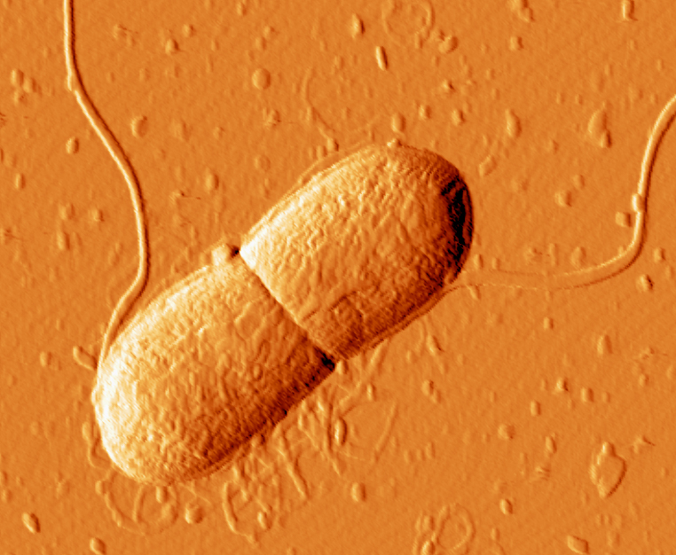 Var tjugonde svensk bär på resistenta bakterier