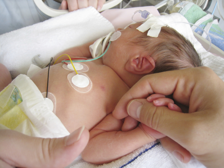 ”Neonatalvården rena resebyråverksamheten”